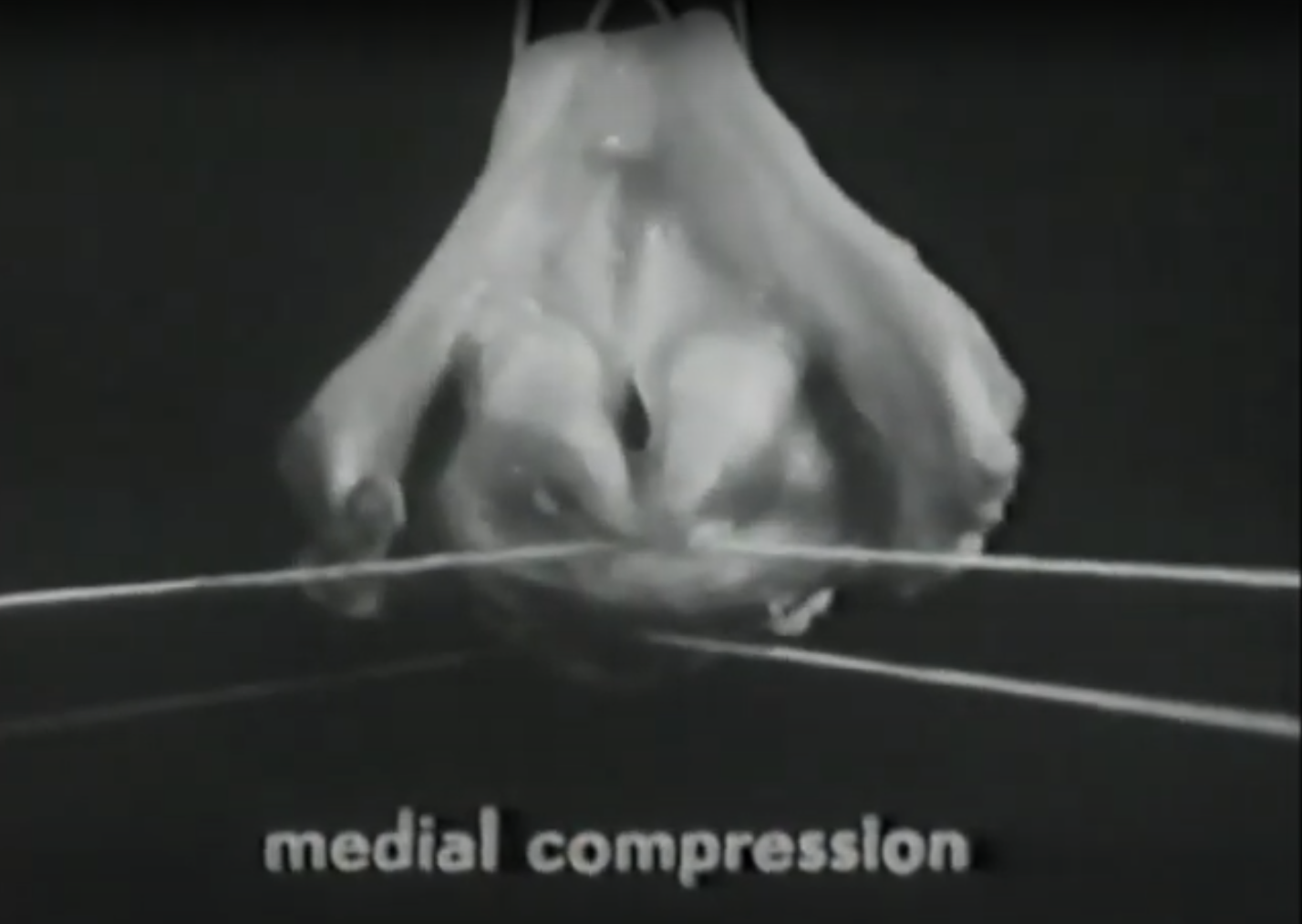 The Vocal Folds: The Source of Your Sound (Part 2 – Compression)